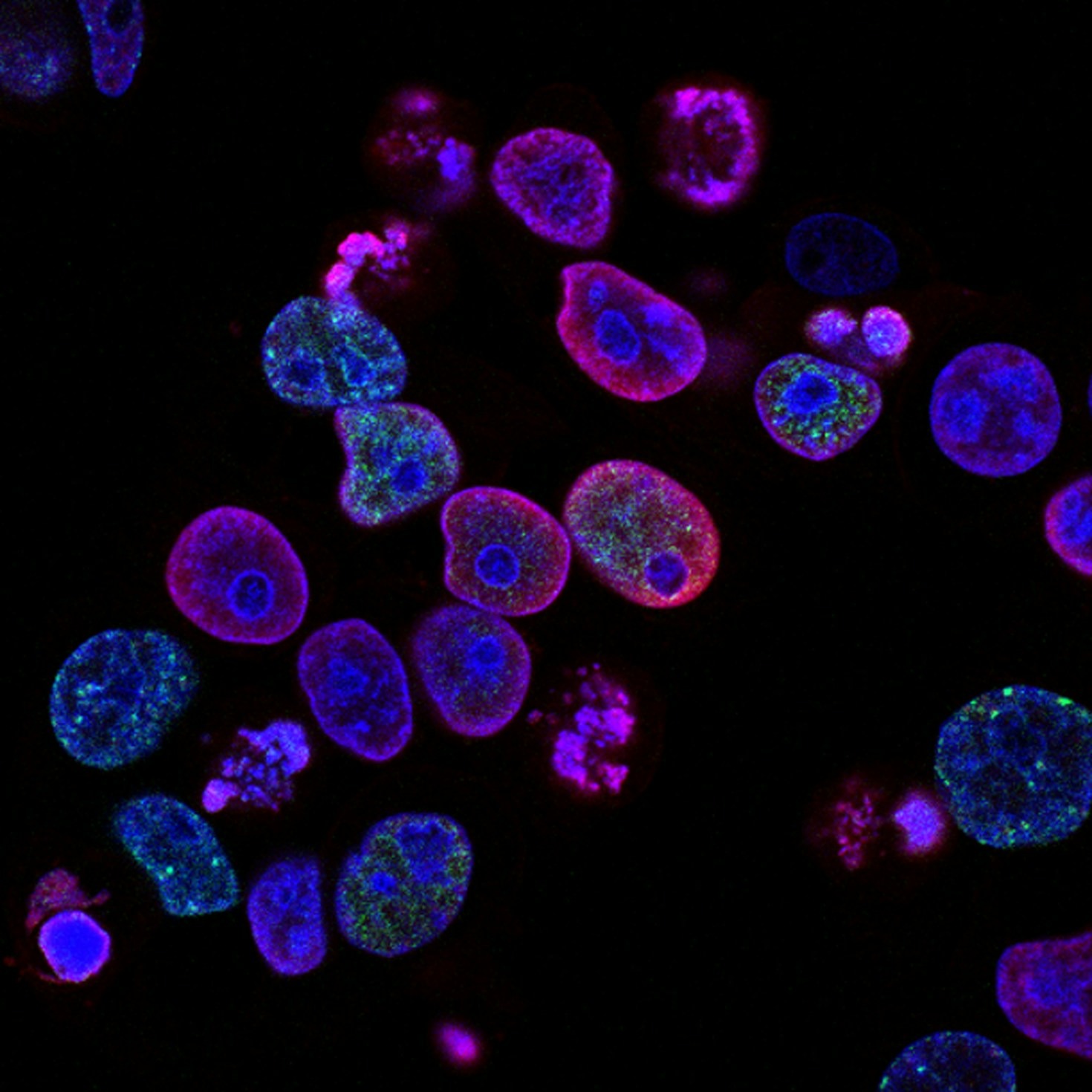 The Science Behind Regenerative Medicine Breakthroughs
